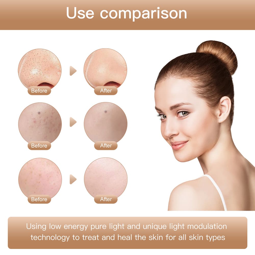 косметическая маска для лица с фотонной терапией против морщин для лица