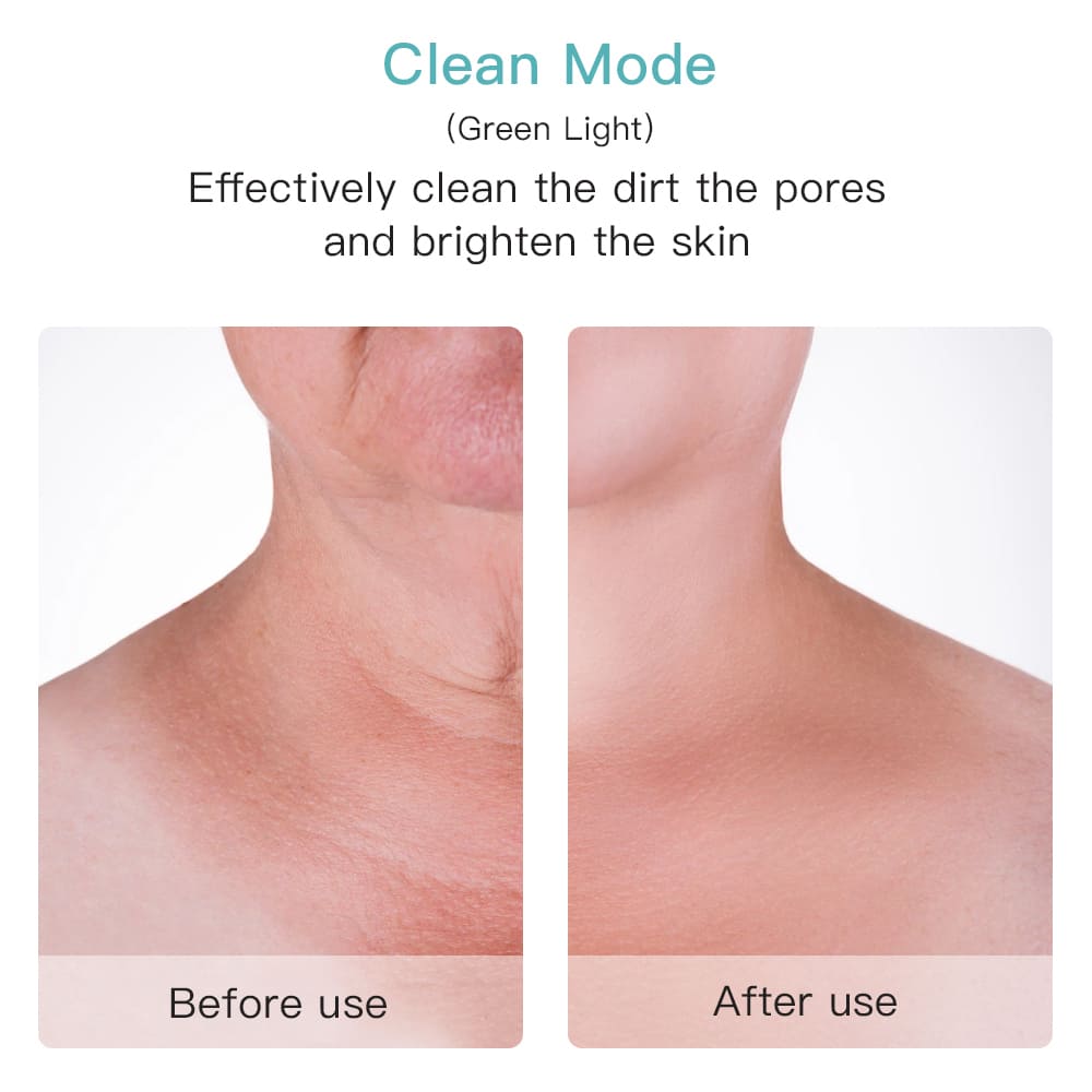 Эффективный очиститель пор на лице или шее до и после